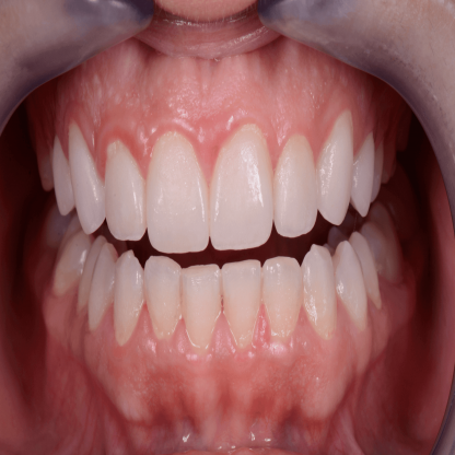 Biofilm Discloser 241