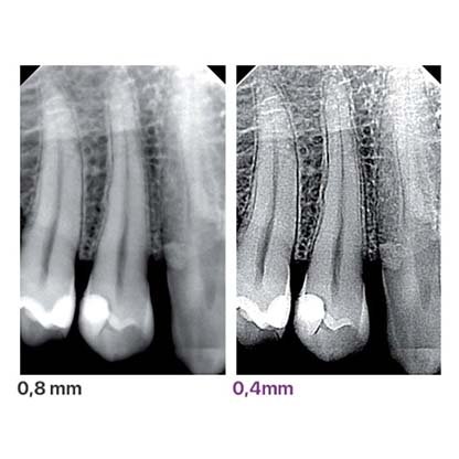 RXDC eXTend Wireless 72